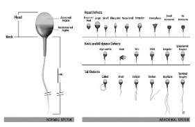 sperm