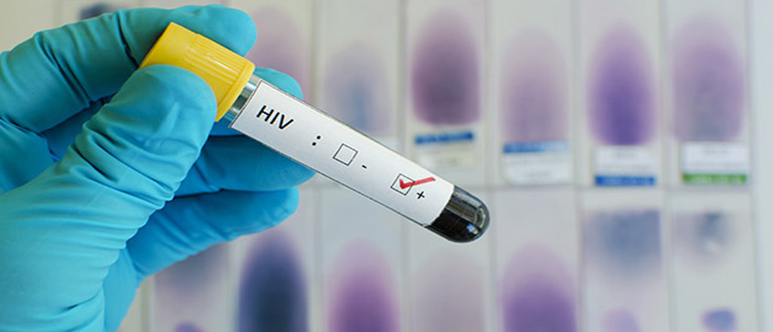 western blot testi