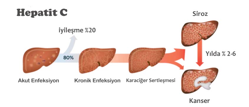 hepatit c testi