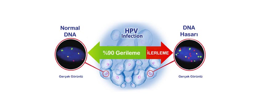 hpv tiplendirmesi nedir