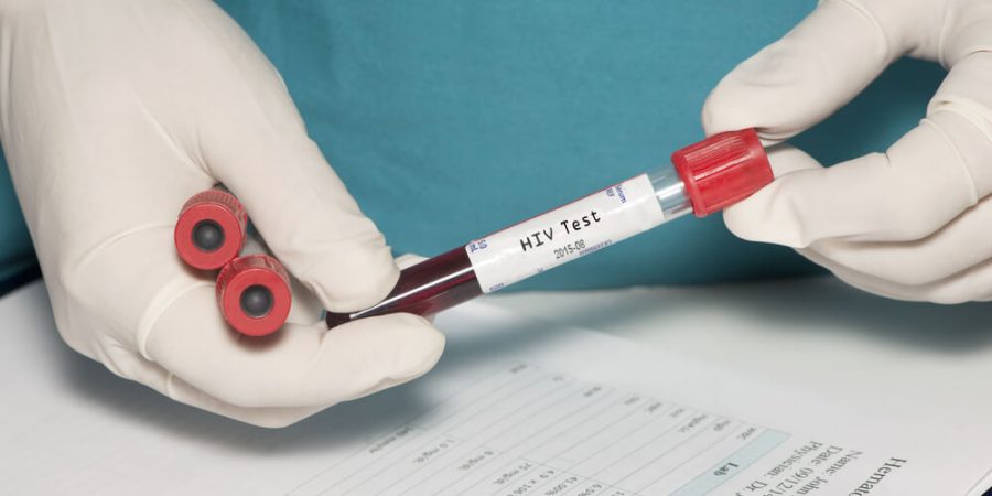 anti hiv testi