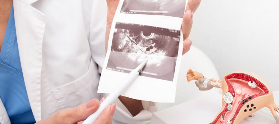 transvajinal ultrasonografi nedir