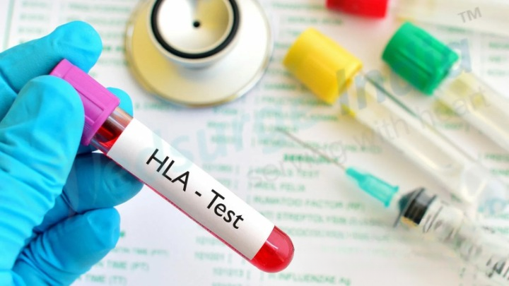 hla test
