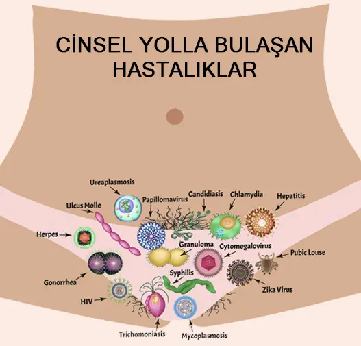 cinsel-yolla-bulasan-hastaliklar-ozeti