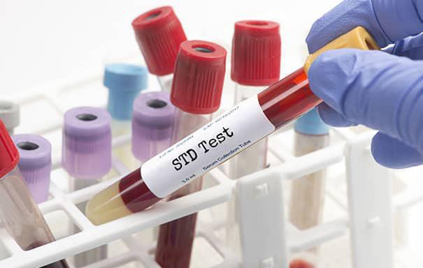 std testi